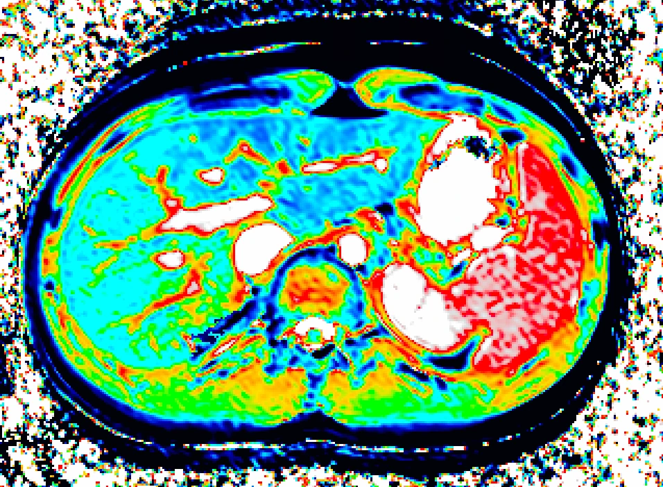 Use of in vivo imaging and physiologically based kinetic modelling to predict hepatic transporter mediated drug-drug interactions in rats