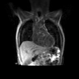 Imaging human lung perfusion with contrast media: a meta-analysis